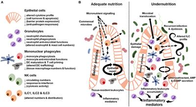 Current Understanding of Innate Immune Cell Dysfunction in Childhood <mark class="highlighted">Undernutrition</mark>